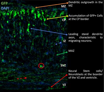 Estradiol and the Development of the Cerebral Cortex: An Unexpected Role?